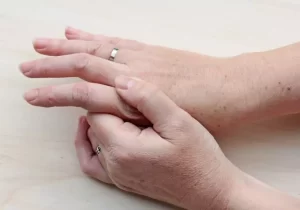 بیماری‌های مرتبط با خشکی پوست